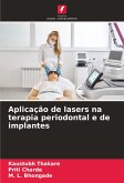 Aplicação de lasers na terapia periodontal e de implantes