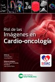 Rol de las imágenes en cardio-oncología (eBook, ePUB) Rol de las imágenes en cardio-oncología (eBook, ePUB)