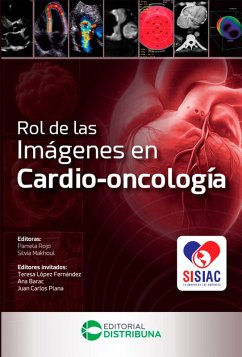 Cover Rol de las imágenes en cardio-oncología (eBook, ePUB)