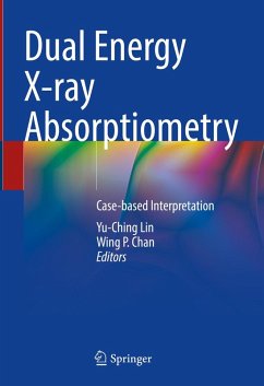 Cover Dual Energy X-ray Absorptiometry (eBook, PDF)