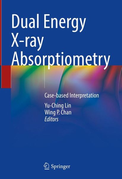 Dual Energy X-ray Absorptiometry (eBook, PDF)