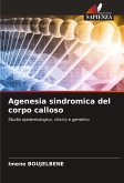 Agenesia sindromica del corpo calloso