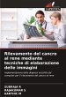 Rilevamento del cancro al rene mediante... - Bild 1