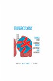 Tuberculosis (eBook, ePUB)