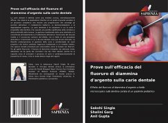 Prove sull'efficacia del fluoruro di diammina d'argento sulla carie dentale - Singla, Sakshi;Garg, Shalini;Gupta, Anil