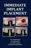 Immediate Implant Placement Immediate Implant Placement