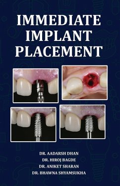 Immediate Implant Placement - Dhan, Aadarsh