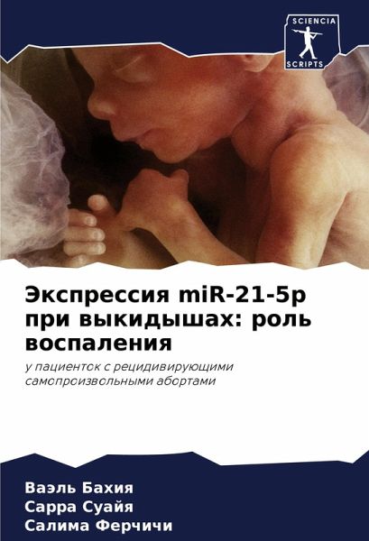 Jexpressiq miR-21-5p pri wykidyshah: rol' wospaleniq
