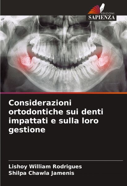 Considerazioni ortodontiche sui denti impattati e sulla loro gestione