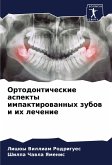 Ortodonticheskie aspekty impaktirowannyh zubow i ih lechenie Ortodonticheskie aspekty impaktirowannyh zubow i ih lechenie