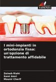 I mini-impianti in ortodonzia fissa: un'opzione di trattamento affidabile