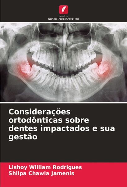 Considerações ortodônticas sobre dentes impactados e sua gestão Considerações ortodônticas sobre dentes impactados e sua gestão