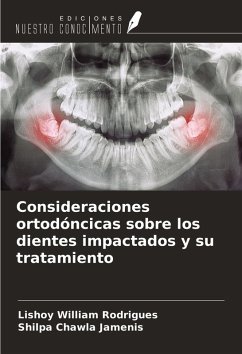 Cover Consideraciones ortodóncicas sobre los dientes impactados y su tratamiento