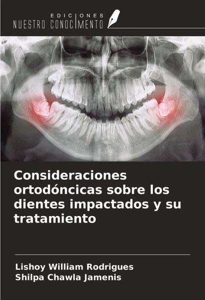 Consideraciones ortodóncicas sobre los dientes impactados y su tratamiento Consideraciones ortodóncicas sobre los dientes impactados y su tratamiento