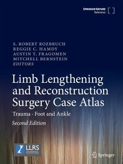 Limb Lengthening and Reconstruction Surgery Case Atlas