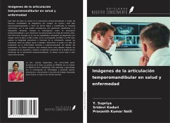 Imágenes de la articulación temporomandibular en salud y enfermedad - Supriya, Y.; Koduri, Sridevi; Nalli, Prasanth Kumar