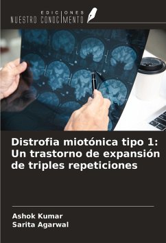 Distrofia miotónica tipo 1: Un trastorno de expansión de triples repeticiones - Kumar, Ashok; Agarwal, Sarita