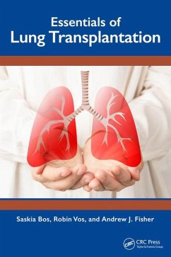 Essentials of Lung Transplantation - Bos, Saskia; Vos, Robin; Fisher, Andrew J.