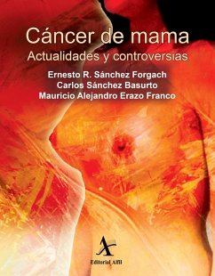 Cover Cáncer de mama. Actualidades y controversias (eBook, PDF)
