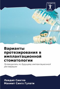Cover Varianty protezirowaniq w implantacionnoj stomatologii