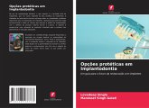 Opções protéticas em Implantodontia