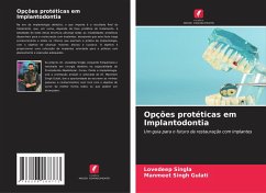 Cover Opções protéticas em Implantodontia