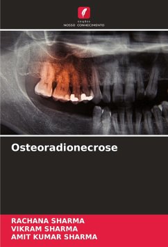 Osteoradionecrose - SHARMA, RACHANA;Sharma, Vikram;Sharma, Amit Kumar