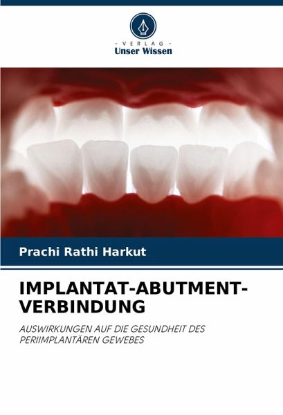 IMPLANTAT-ABUTMENT-VERBINDUNG