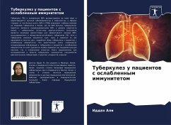 Cover Tuberkulez u pacientow s oslablennym immunitetom