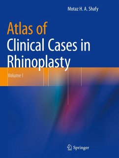 Atlas of Clinical Cases in Rhinoplasty Cover Atlas of Clinical Cases in Rhinoplasty