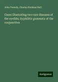 Cases illustrating two rare diseases of the eyelids; Syphilitic gummata of the conjunctiva