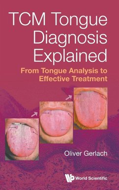 Tcm Tongue Diagnosis Explained: From Tongue Analysis to Effective Treatment Tcm Tongue Diagnosis Explained: From Tongue Analysis to Effective Treatment