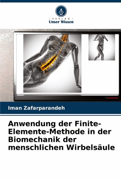 Anwendung der Finite-Elemente-Methode in der Biomechanik der menschlichen Wirbelsäule Anwendung der Finite-Elemente-Methode in der Biomechanik der menschlichen Wirbelsäule