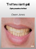 Trattare I Denti Gialli (eBook, ePUB)