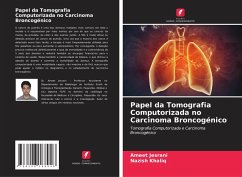 Cover Papel da Tomografia Computorizada no Carcinoma Broncogénico