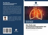 Die Rolle der Computertomographie bei Bronchialkarzinomen Die Rolle der Computertomographie bei Bronchialkarzinomen