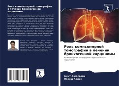 Cover Rol' komp'üternoj tomografii w lechenii bronhogennoj karcinomy