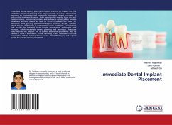 Immediate Dental Implant Placement - Rajendran, Reshma;Roshan T, John;GA, Adhersh