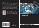 Liposuction Liposuction