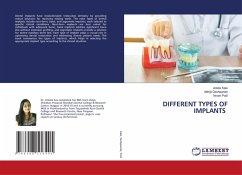 Cover DIFFERENT TYPES OF IMPLANTS