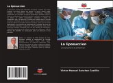 La liposuccion