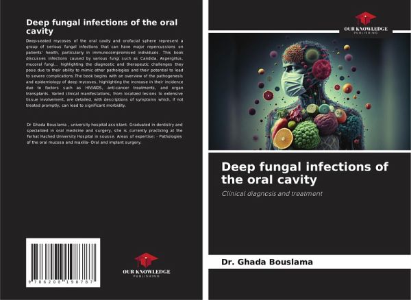 Deep fungal infections of the oral cavity