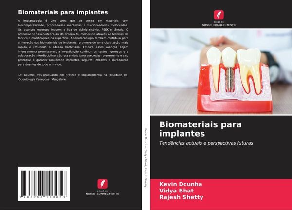 Biomateriais para implantes