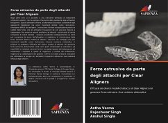 Cover Forze estrusive da parte degli attacchi per Clear Aligners