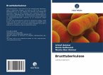 Brusttuberkulose Brusttuberkulose