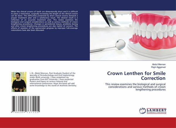 Crown Lenthen for Smile Correction