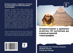 Cover Ateroskleroz u drewnih egiptqn: Ot autopsii do komp'üternoj tomografii
