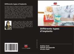 Cover Différents types d'implants