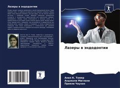 Lazery w ändodontii - Tomer, Anil K.;Miglani, Andzhali;Chauhan, Priqli