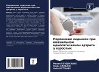 Porazhenie lodyzhek pri üwenil'nom idiopaticheskom artrite u wzroslyh
